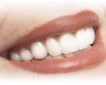 witte tanden